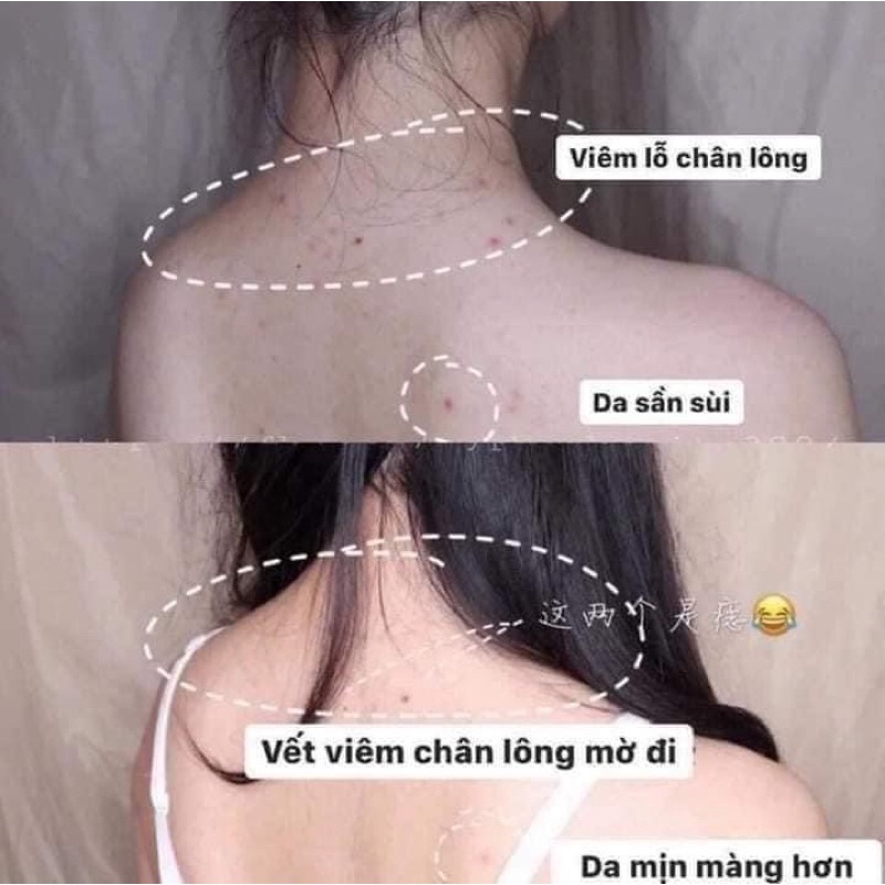 XỊT KHOÁNG VIÊN DA VIÊM LỖ CHÂN LÔNG  LƯNG THE MAGIC CLEAR BODY MIST