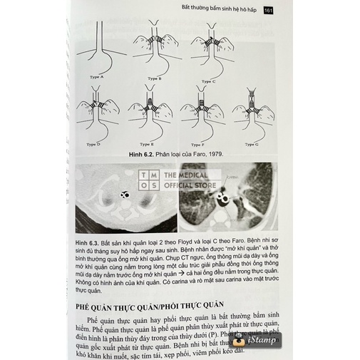 Sách - Chẩn Đoán Hình Ảnh Nhi Khoa Tmos