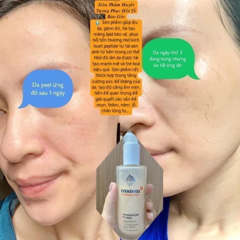 Huyết Tương Siêu Phục Hồi Da EVENSWISS PLASMA REGENERATING 50ml