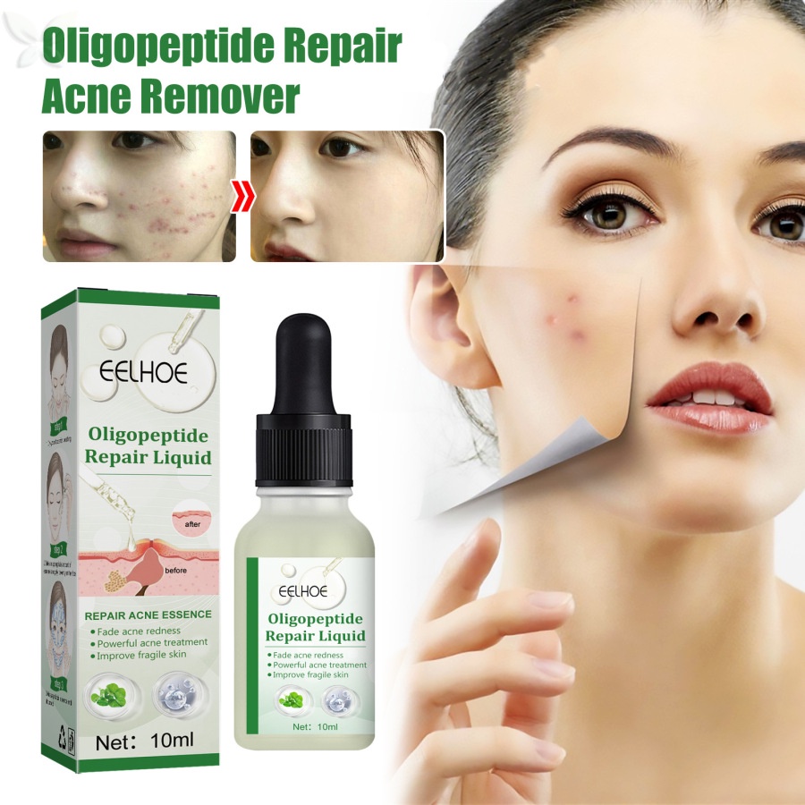 Tinh chất Oligopeptide vovigo 10ml hỗ trợ giảm mụn làm trắng dưỡng ẩm kiềm dầu thu nhỏ lỗ chân lông