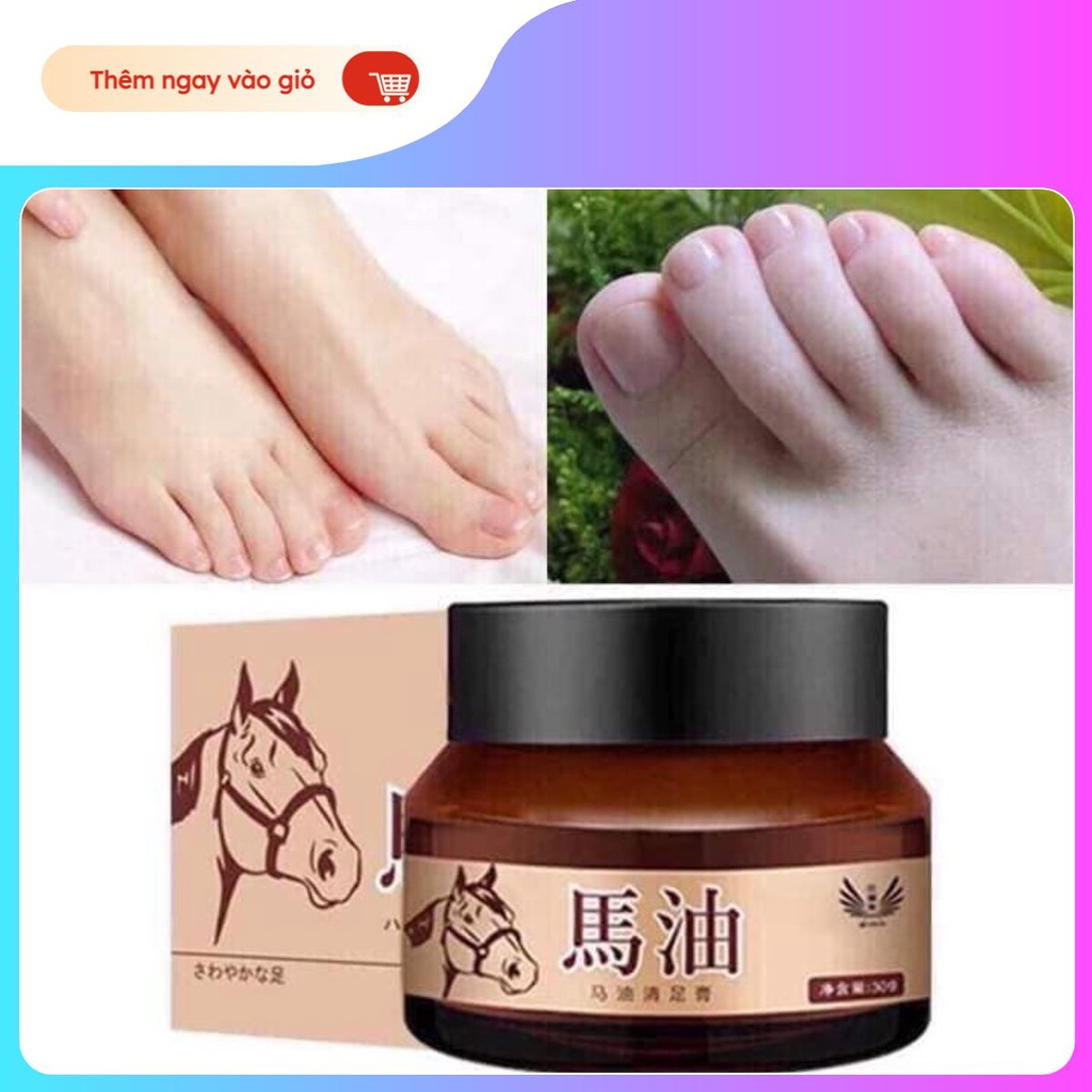 Kem bôi nẻ gót chân cá ngựa, bôi cực thích