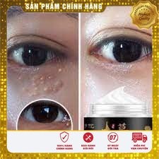 Kem tri mụn thịt quanh mắt