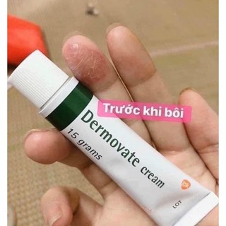 KEM D E M O V A T E  THÁI LAN