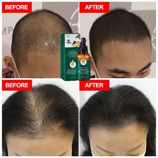 Tinh dầu mọc tóc dầu mọc tóc nhanh mọc tóc chống rụng tóc