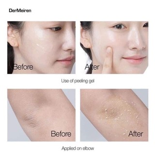 𝐓𝐀̂̉𝐘 𝐃𝐀 𝐂𝐇𝐄̂́𝐓 𝐑𝐀𝐔 𝐌𝐀́ 𝐏𝐑𝐄𝐓𝐓𝐘𝐒𝐊𝐈𝐍 150ml