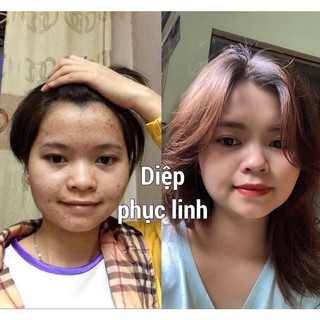 Diệp phục linh Em 10ml