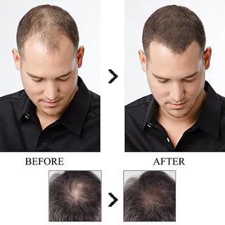 Phấn Phủ Chân Tóc Derf 27.5g Giúp Giảm Rụng Tóc