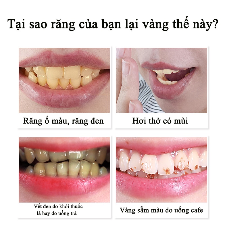 Kem Đánh Răng Làm trắng răng kem đánh răng 180g loại bỏ mảng bám trên răng nhanh chóng ố cao răng ngăn ngừa hôi miệng