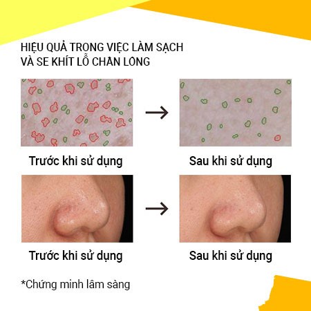 Mặt Nạ Tro Núi Lửa Innisfree Super Volcanic Pore Clay Mask 2X100ml