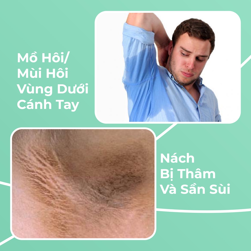 Xịt Hôi Nách Colaco Chính Hãng,  Khử Mùi Hôi Nách Hôi Chân Giảm Tiết Mồ Hôi Tay Chân, Dứt Điểm Sau 1 Liệu Trình