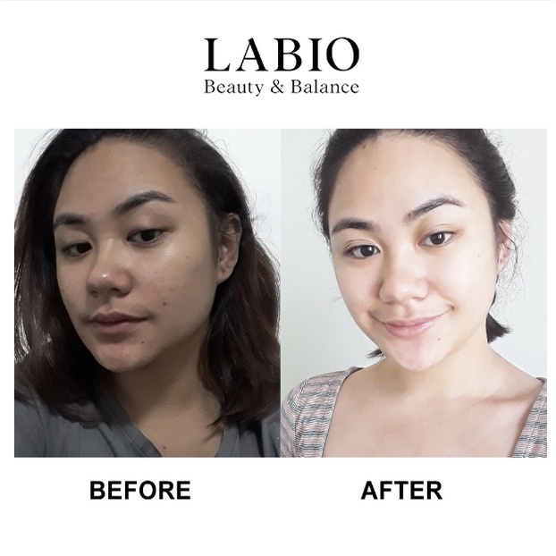 Kem Dưỡng Trắng Tế Bào Gốc LABIO Glutathione 30ml - Trẻ Hóa Da An Toàn Với Retinol Công Nghệ Bọc Hạt