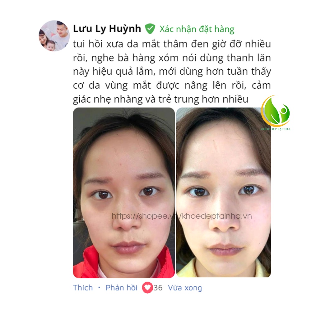 Thanh lăn tan bọng mắt SKIK - Giảm thâm quầng mắt, đánh tan bọng mắt, dưỡng da vùng mắt, giảm nếp nhăn, chân chim