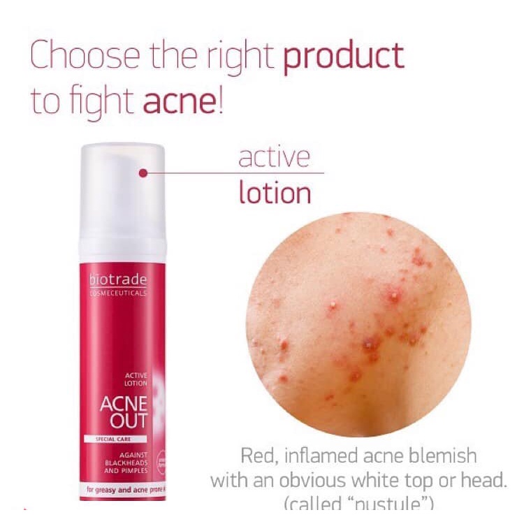 BIOTRADE  Lotion giảm mụn Biotrade Acne Out Active Lotion 10ml