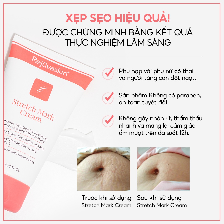 Kem phòng ngừa và làm mờ rạn da REJUVASKIN Stretch Mark Cream 90ml