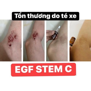 [Isov] TẾ BÀO GỐC EGF