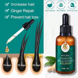Tinh dầu mọc tóc dầu mọc tóc nhanh mọc tóc chống rụng tóc