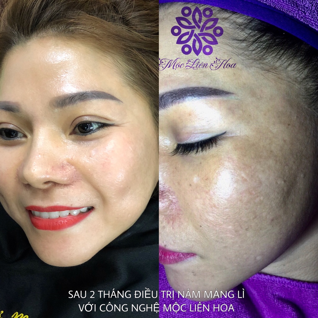 Tailor Made K ULTRA SPOT Kem Quế Hoa