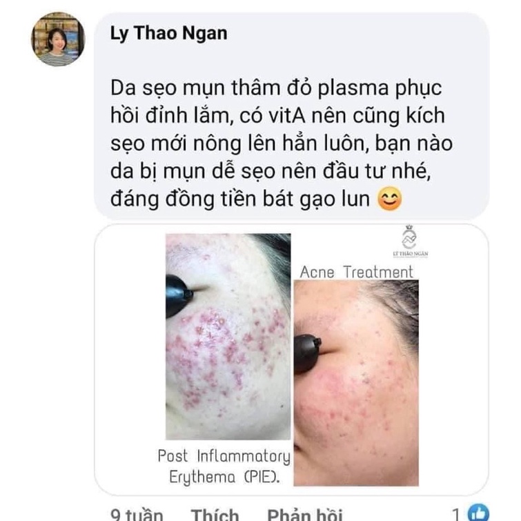 Huyết tương Evenswiss Regenerating Plasma 50ml mẫu mới