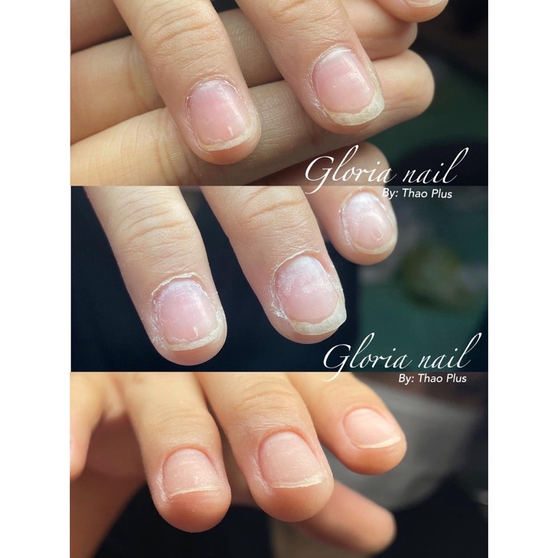 Đầu mài da nhọn đẩy da ẩn