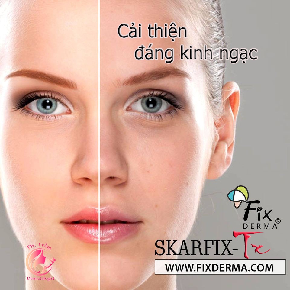 Fixderma Skarfix tx Cream - Kem dưỡng da mờ nám, giảm thâm