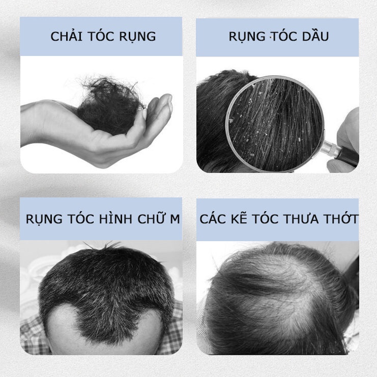 Dầu gội kích thích mọc tóc Dầu gội mọc tóc Giảm Gãy Rụng Dầu Gội Mọc Tóc Nhanh kiểm soát dầu loại bỏ gàu