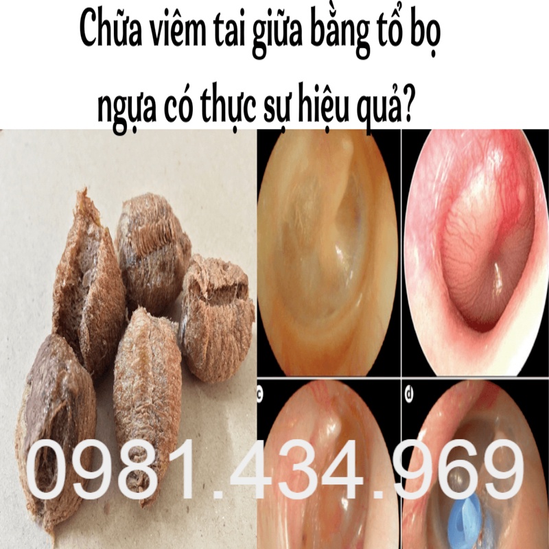 Tang Phiêu Tiêu  khô Mủ tai