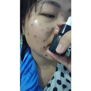 Serum Thảo Dược