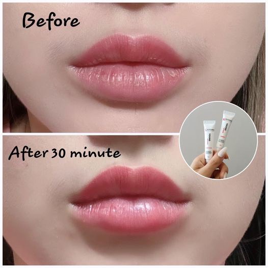 Son dưỡng cấp ẩm và son treatment Kyunglab,  Young Lip Cream &amp; Young Lip Repair giúp cấp ẩm, làm dịu và ngăn hư tổn môi