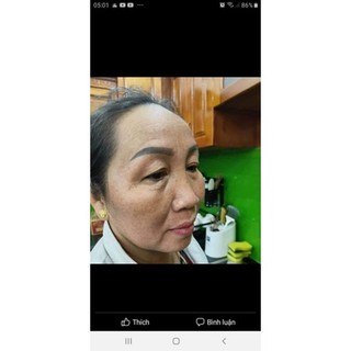 tuýt lẻ clobetamil g