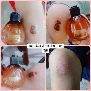 Mỡ trăn n'store nguyên chất triệt lông