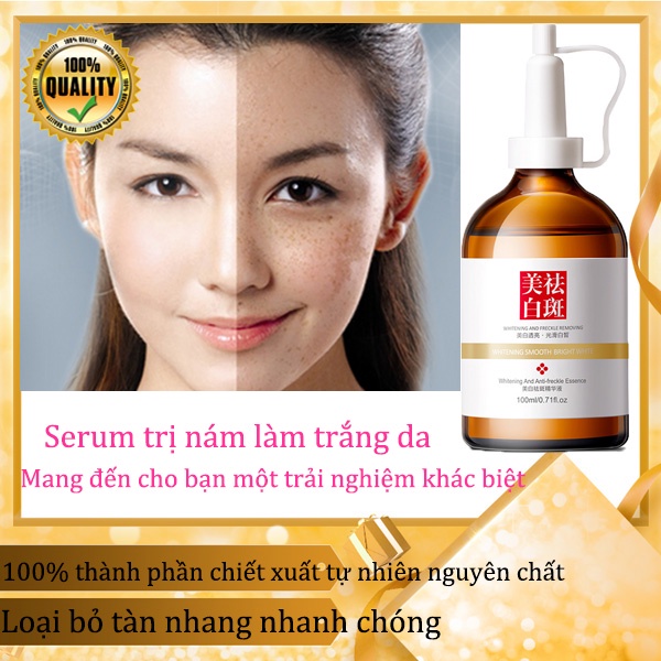 Serum loại bỏ nám trắng da trị thâm mụn trị tàn nhang xóa nám chuyên sâu Loại bỏ nám da sáng rạng rỡ Kiềm dầu dưỡng