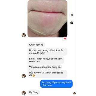 MẶT NẠ TƯƠI NGHỆ MẬT ONG ( SẢN PHẨM HANDMADE )