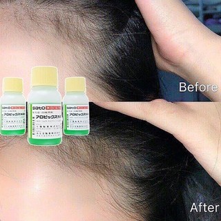 Tinh Chất Kích Thích Mọc Tóc Sato Nhật Bản 30ml
