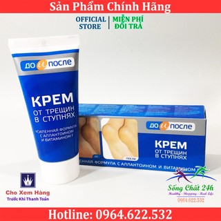 Kem Bôi Loại Bỏ Nứt Gót Chân Kpem Apteka Nga Tuýp 50ml - Sống Chất 24h