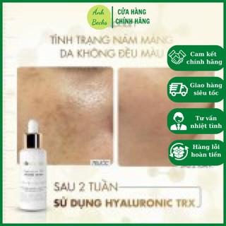Serum giảm sạm nám Ekseption Hyaluronic TRX