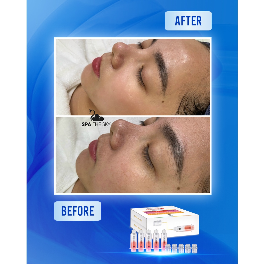 Deepshoot HA cấp ẩm cho da giúp da căng bóng trắng sáng...