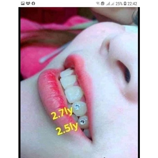 Đá đính răng giá rẻ chân bằng lẻ 1 viên ( 2 k)