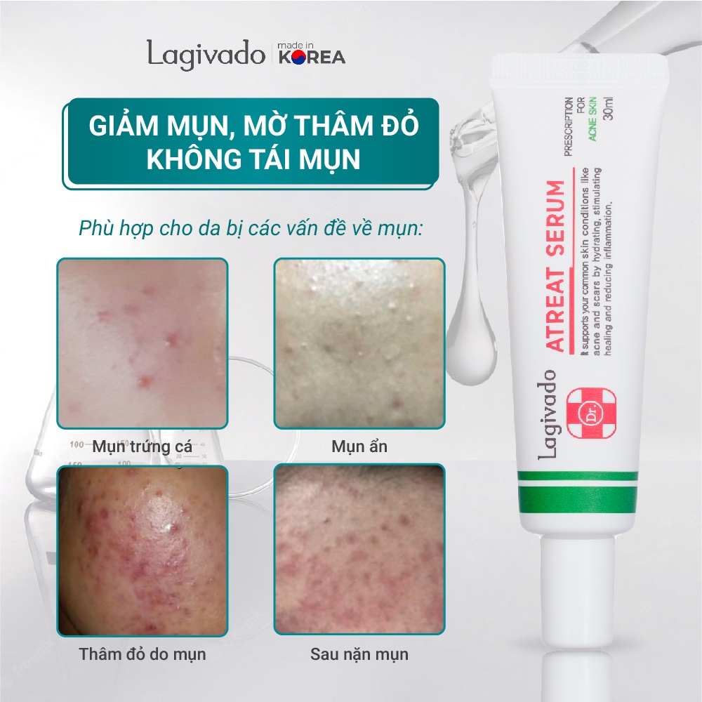 Tinh chất serum giảm mụn, mờ thâm, ngừa sẹo rỗ Hàn Quốc Lagivado Dr. ATreat Serum 30ml