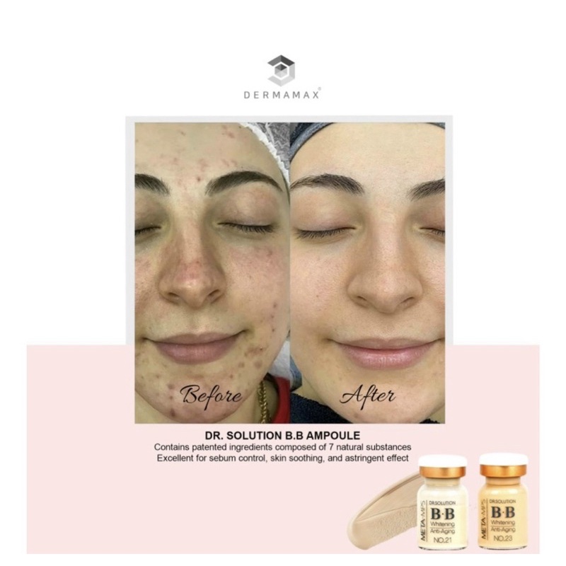 Cấy phấn hàn quốc, cấy trắng da hàng chuẩn kèm tế bào gố trắng da