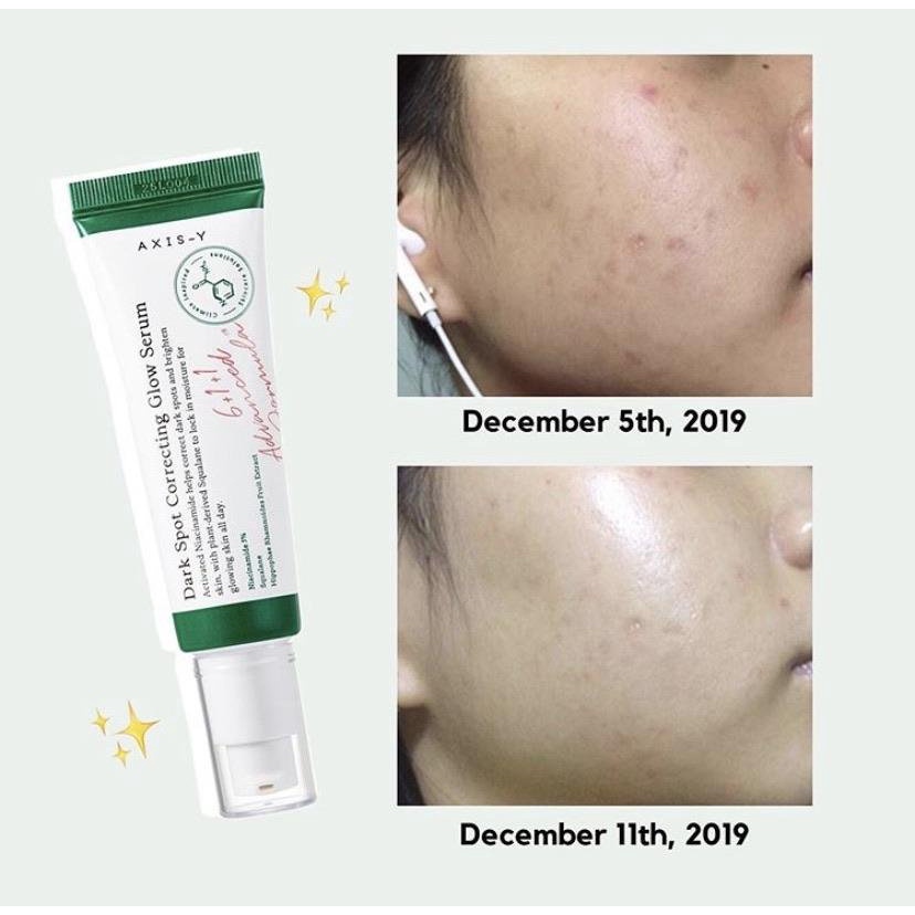 Tinh Chất Sáng Da Mờ Thâm Niacinamide 5% Axis-Y Dark Spot Correcting Glow Serum 50ml