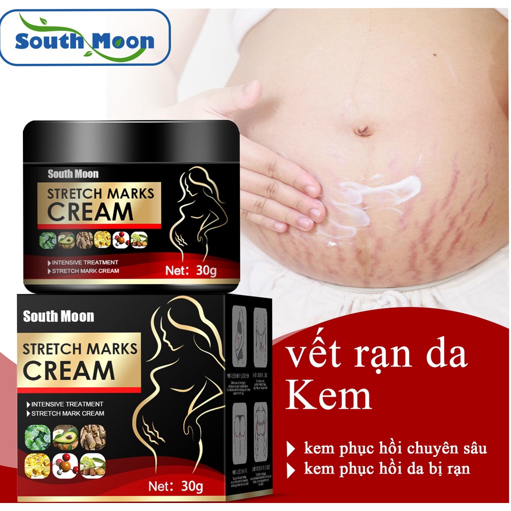 kem trị rạn da Kem chống rạn da 30g kem rạn da bà bầu trước sinh sau sinh