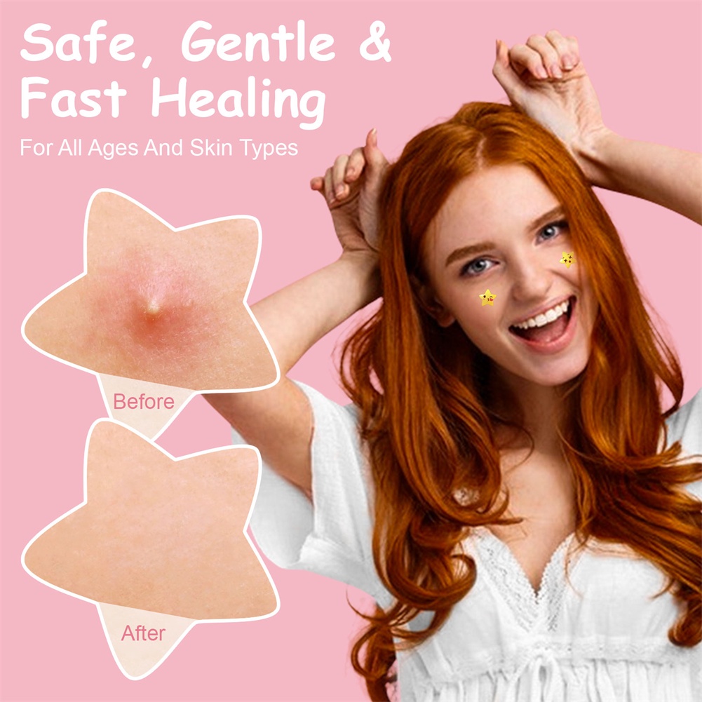 Miếng Dán Hỗ trợ giảm mụn Thoáng Khí Chăm Sóc Da Mặt