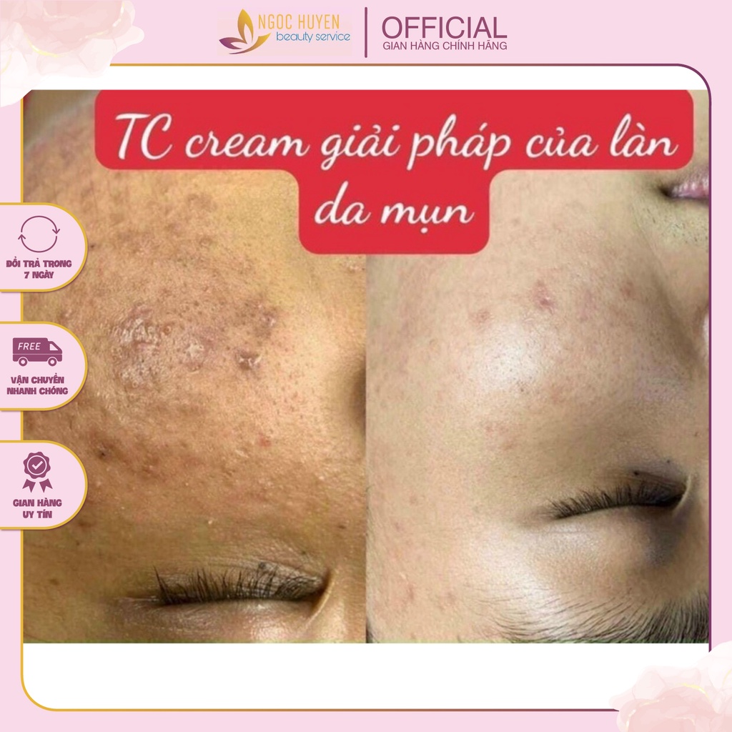 ⚡ Kem Giảm Mụn Thâm Isov Centella TC Cream Tái Tạo Da