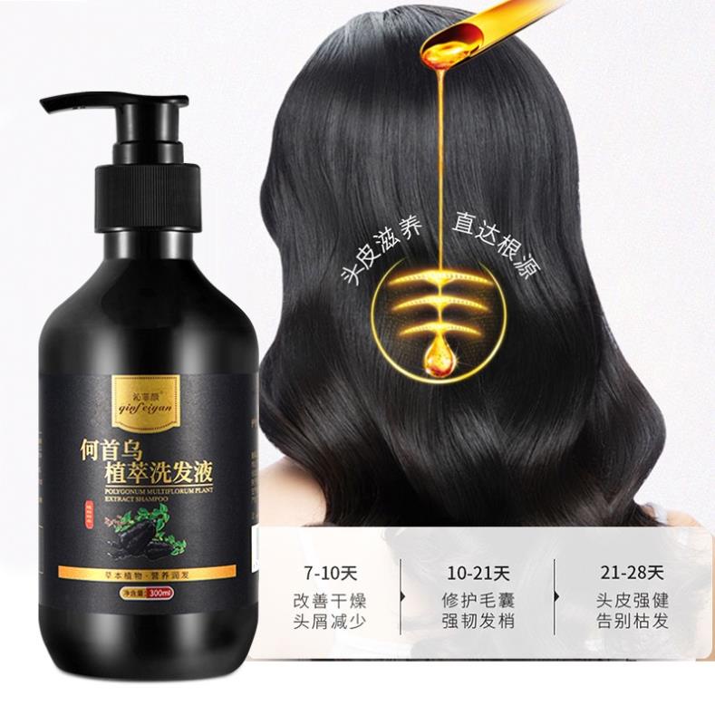 Dầu Gội Youlan Feisi Chứa Polygonum Multiflorum Giúp Nuôi Dưỡng Tóc