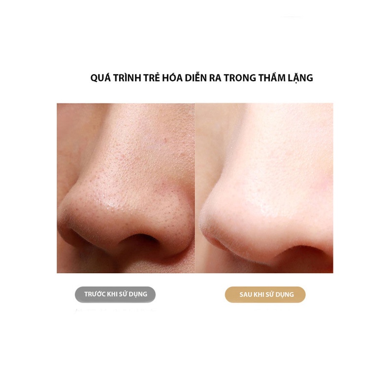 Máy Cà Da Ultrasonic Điên Di Tinh Chất Làm Sạch Sâu Da Mặt Lấy Đi Da Chết Bụi Bẩn Mụn Ẩn