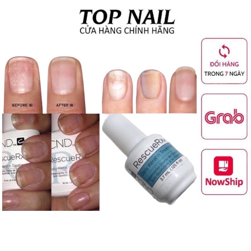 Dưỡng phục hồi móng CND RescueRXx 3,7ml nhập khẩu Mỹ chính hãng - Thần dược cải thiện hư tổn, kích thích mọc móng