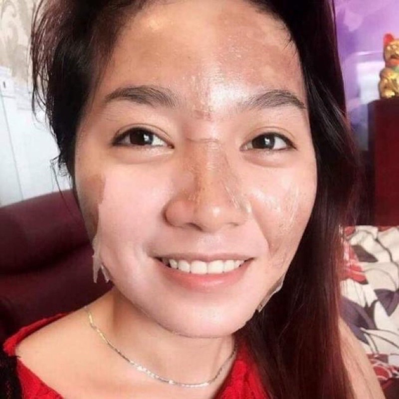 𝐓𝐂𝐀 𝐂𝐇𝐀̂́𝐌 𝐍𝐀́𝐌 - 𝐂𝐇𝐀̂́𝐌 𝐓𝐀̀𝐍 𝐍𝐇𝐀𝐍𝐆 rỗ, peell da hết thâm, nách bẹn handmade