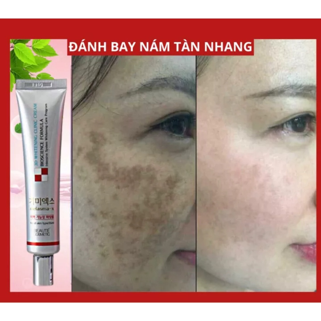 (HÀN QUỐC) TUÝP KEM ĐÁNH BAY NÁM, TÀN NHANG, LOẠI BỎ ĐỐM NÂU VÀ CÁC VẾT THÂM SẠM, TÁI TẠO LÀN DA TRẮNG SÁNG