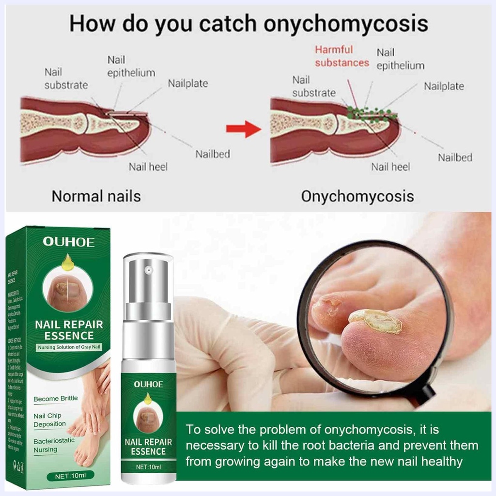 Tinh chất phục hồi chăm sóc móng hư tổn