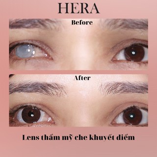 Kính Áp Tròng Thẩm Mỹ Che Khuyết Điểm Mắt Cườm, Kéo Mây, Đục Thủy Tinh Thể Lens Dành Cho Mắt Hỏng - Hera